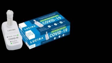 Photo of Coronavirus: autorizan la primera prueba casera para detectar Covid-19