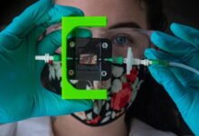 Photo of Investigadores crean un implante que produce insulina para la diabetes tipo 1
