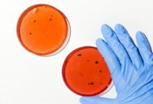 Photo of Inteligencia artificial para combatir bacterias resistentes a los antibióticos