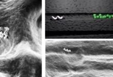 Photo of Científicos crean nanobots capaces de matar las bacterias del interior de los dientes con calor