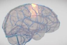 Photo of Synchron vs. Neuralink: La nueva frontera de los implantes cerebrales