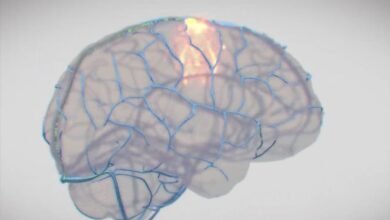 Photo of Synchron vs. Neuralink: La nueva frontera de los implantes cerebrales