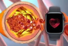 Photo of ¿Cuáles son los valores normales de colesterol? Así puedes registrar su evolución con tu Apple Watch